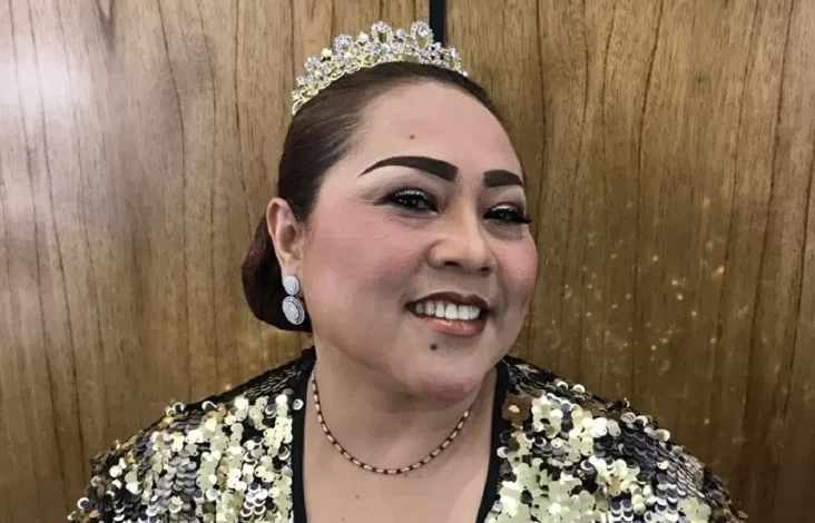 Nunung Stres Bolak-balik Solo-Jakarta untuk Berobat kemudian Bekerja hingga Idap Asam Lambung Kronis